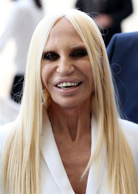 donatella versace estetik faciası|donatella hair.